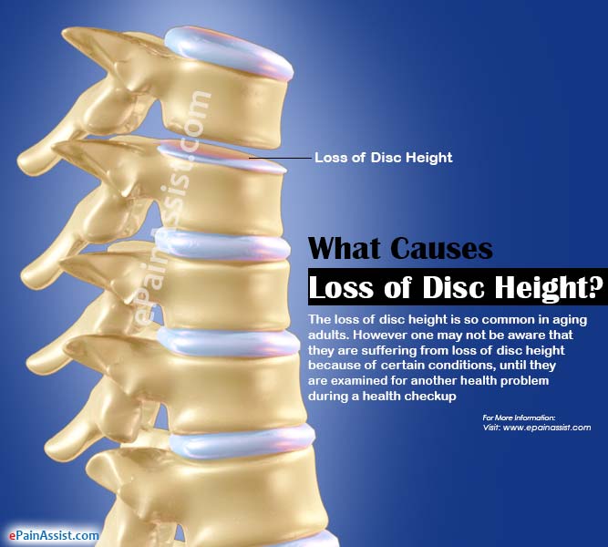 What Causes Loss of Disc Height?