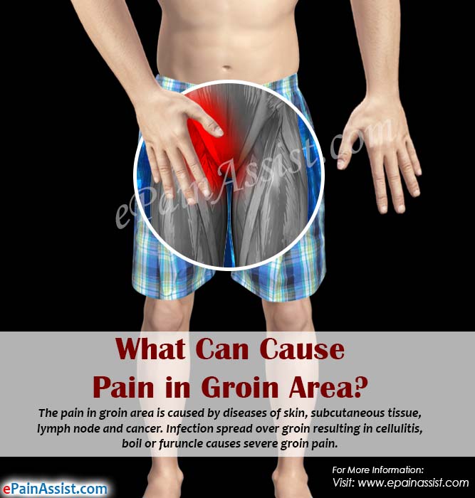 Skin Discoloration Groin Area