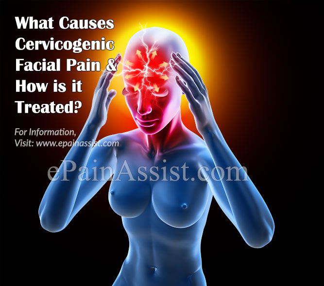 What Causes Cervicogenic Facial Pain?