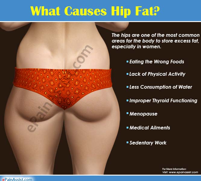 What Causes Hip Fat: Top Causes of Fat Accumulation around Hips