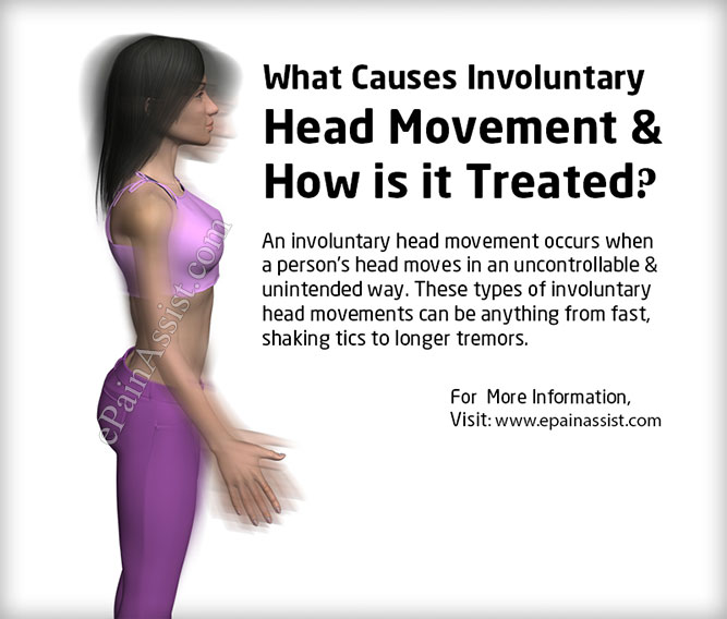 What Causes Involuntary Head Movement & How is it Treated?