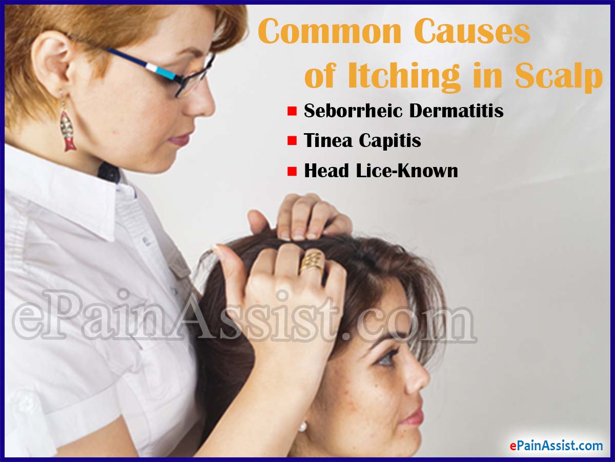 What Causes Itching in Scalp