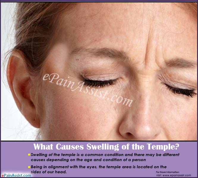 What Causes Swelling of the Temple?