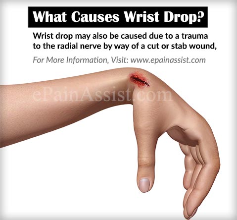 What Causes Wrist Drop?