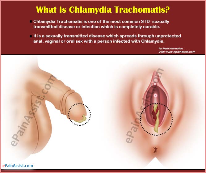 how is chlamydia infection causes