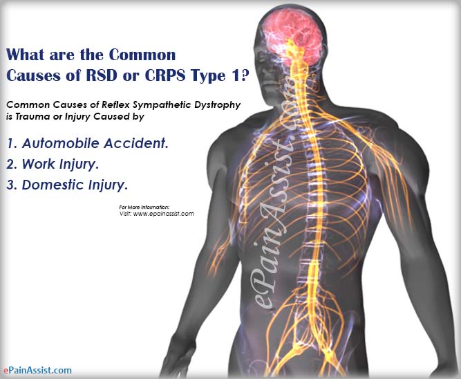 What Are The Common Causes Of Reflex Sympathetic Dystrophy (RSD) or Complex Regional Pain Syndrome (CRPS Type 1)?