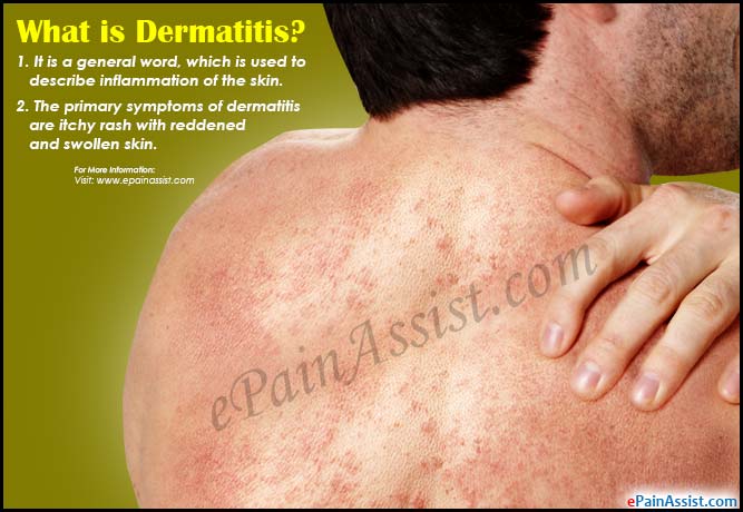 What is Dermatitis?