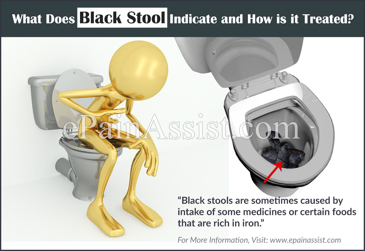 What Does Black Stool Indicate and How is it Treated?