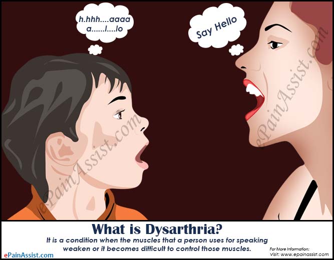 What is Dysarthria?