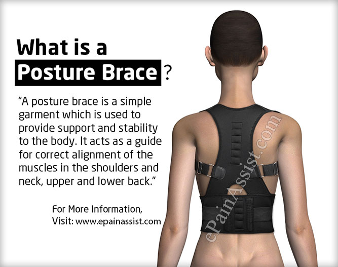 Posture Brace: What is a Posture Brace?