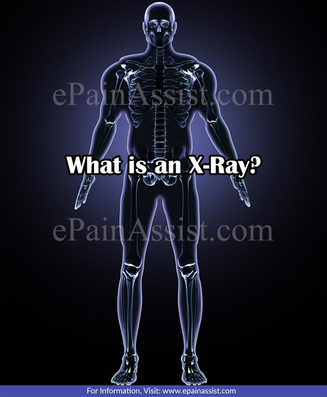 What is an X-Ray?