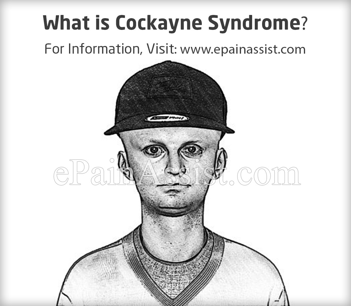 What is Cockayne Syndrome?