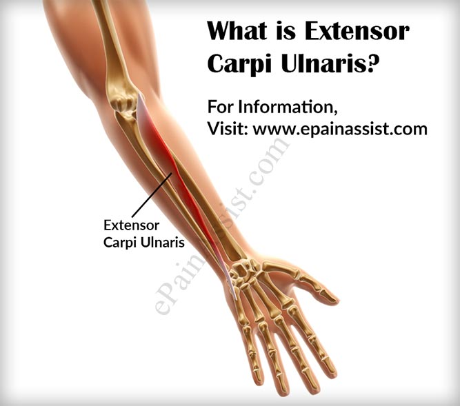 What is Extensor Carpi Ulnaris and What is its Function?