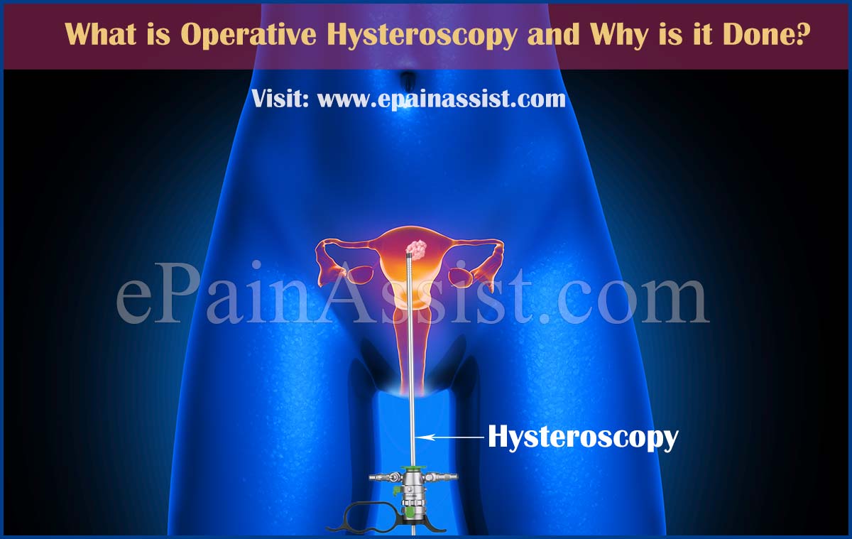 Diagnostic & Operative Hysteroscopy Diagnostic & Operative Hysteroscopy