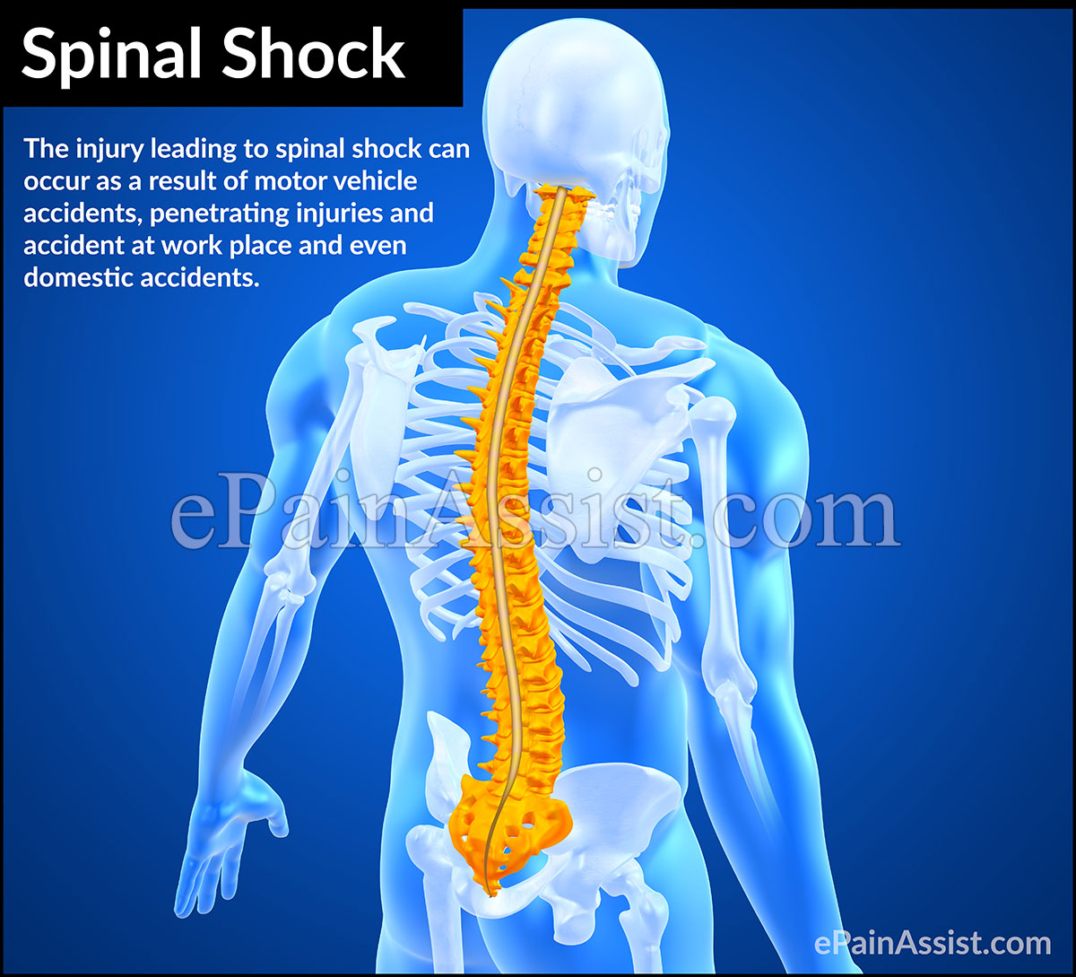 What is Spinal Shock? What is Spinal Shock?
