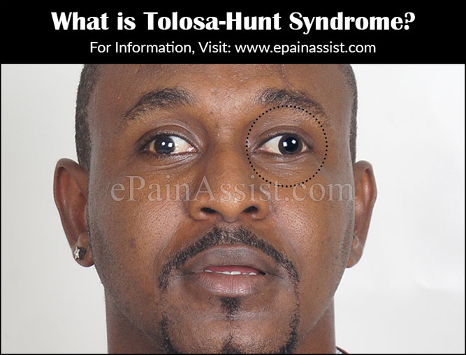 What is Tolosa-Hunt Syndrome?