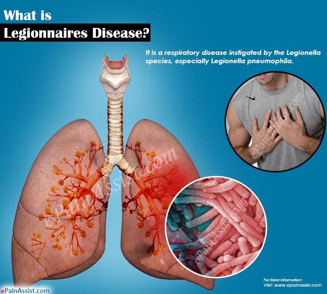 What is Legionnaires Disease?