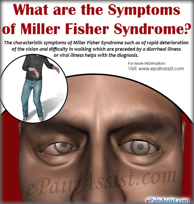 Image result for miller fisher syndrome