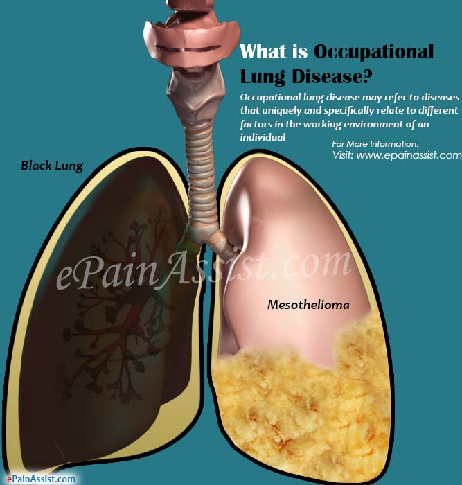 What is Occupational Lung Disease?