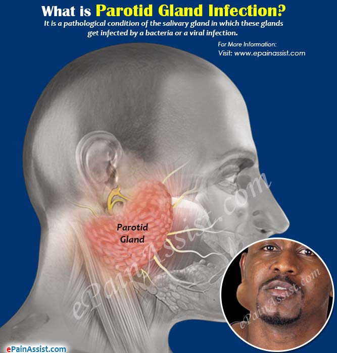 Parotid Gland Infection