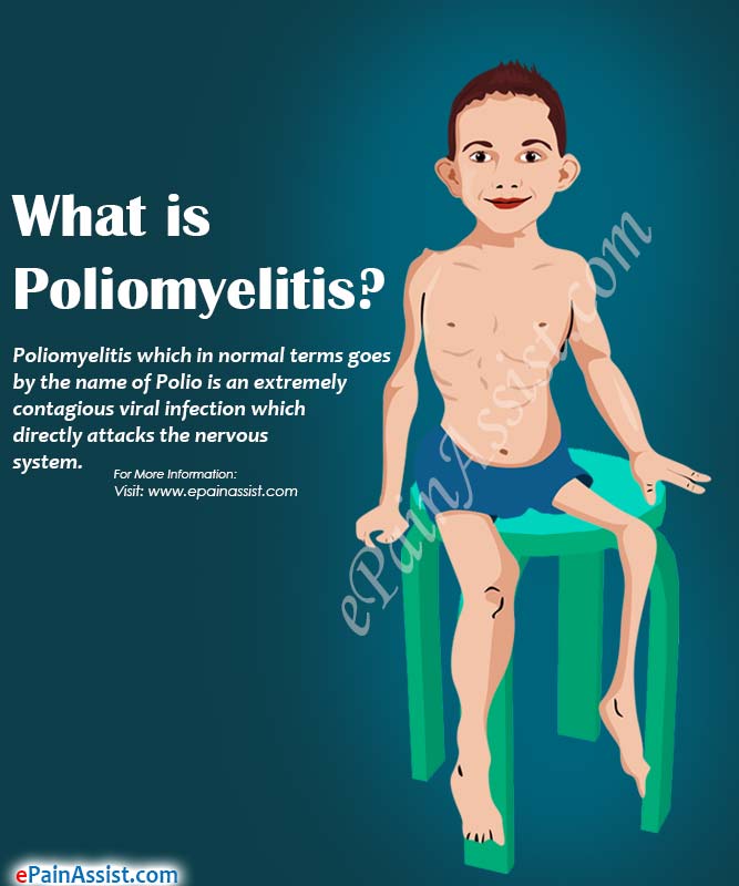 What is Poliomyelitis?