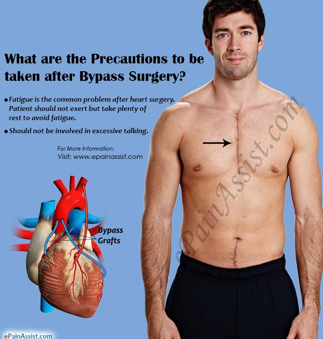 Precautions After Bypass Surgery Know The Dos And Donts After Bypass