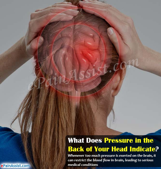 What Does Pressure in the Back of Your Head Indicate?