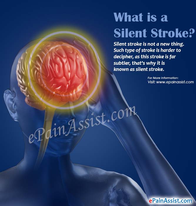 What is a Silent Stroke?