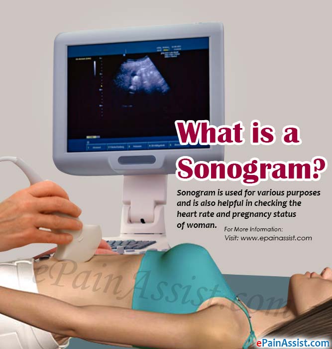 What is a Sonogram?