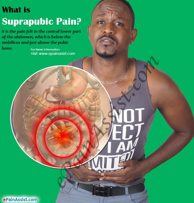 What is Suprapubic Pain?