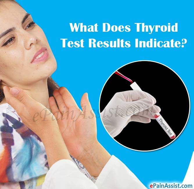 What Does Thyroid Test Results Indicate?