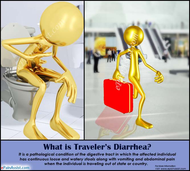 What is Traveler’s Diarrhea?