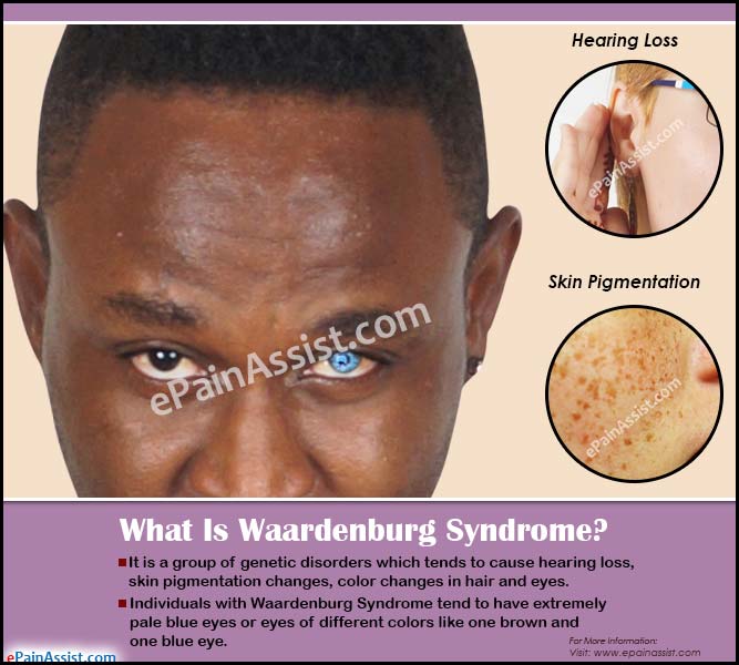 What Is Waardenburg Syndrome?