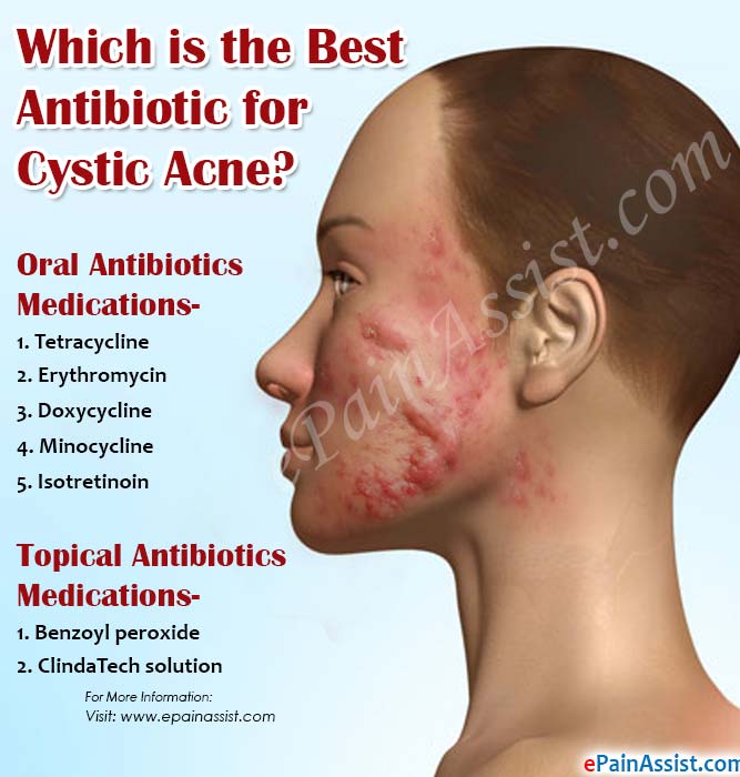 Do you need a prescription for motilium high