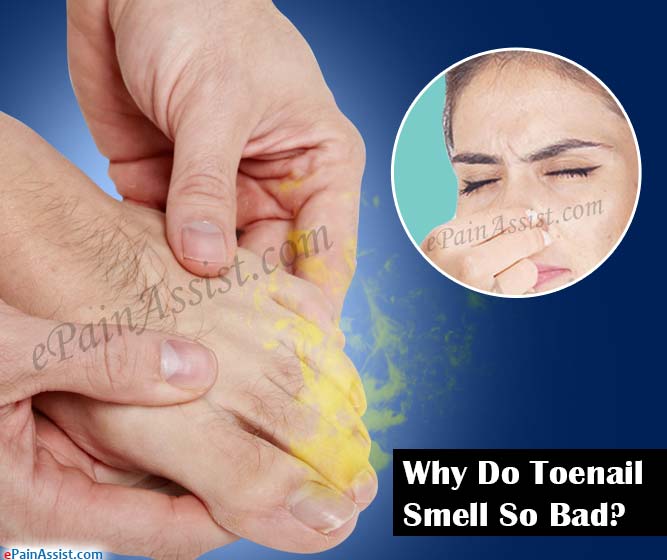 Why Do Toenail Smell So Bad?