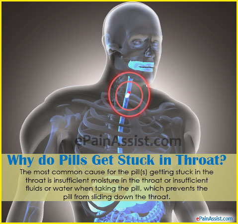 Why do Pills Get Stuck in Throat?