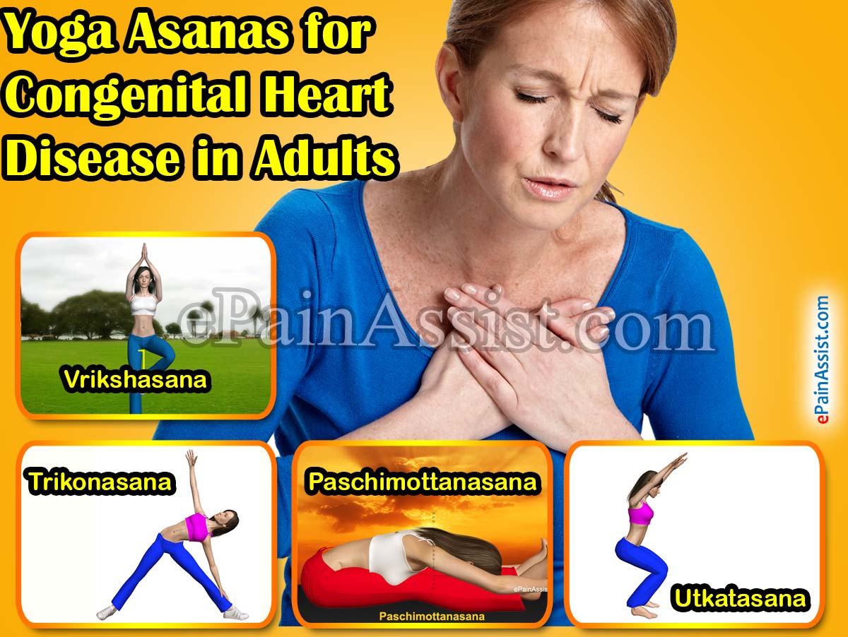 Exercises for Congenital Heart Disease in Adults Exercises for Congenital Heart Disease in Adults