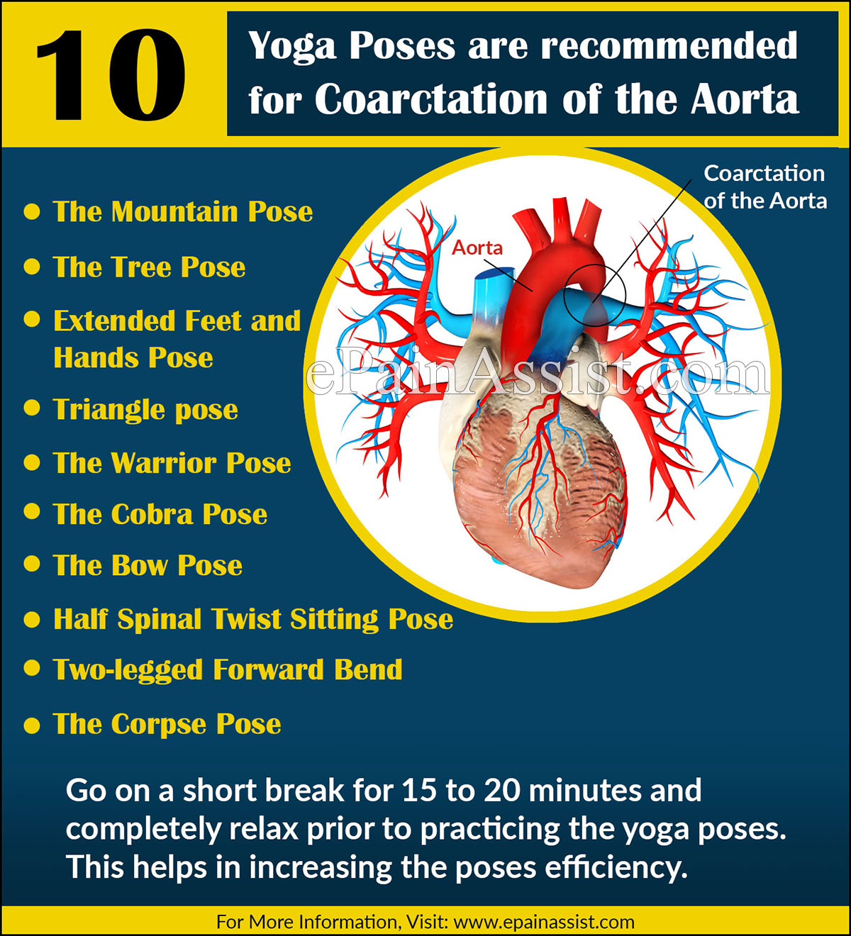 Yoga Poses or Asanas are recommended for Coarctation of the Aorta (COA) or Aortic Narrowing Yoga Poses or Asanas are recommended for Coarctation of the Aorta (COA) or Aortic Narrowing